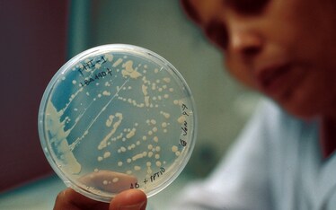 I batteri intestinali decidono cosa mangiamo